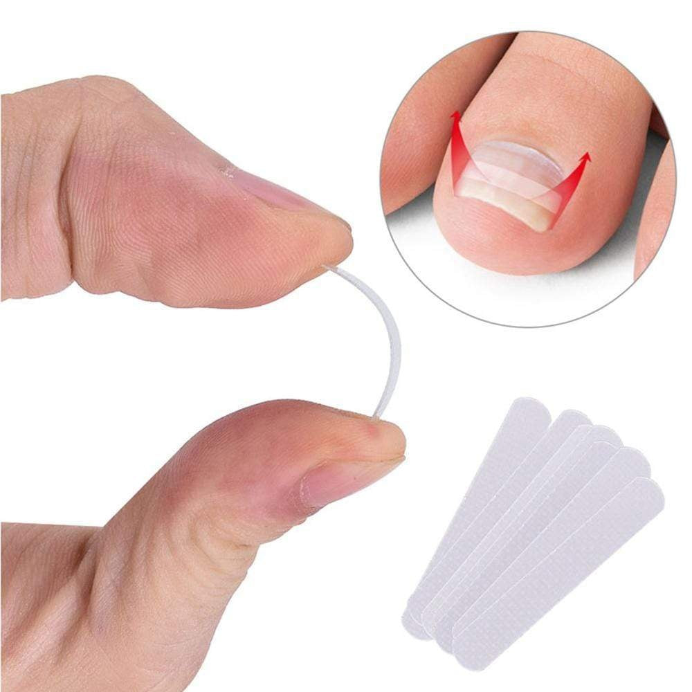 Toenail Repair Clips 10 Pack - Halri