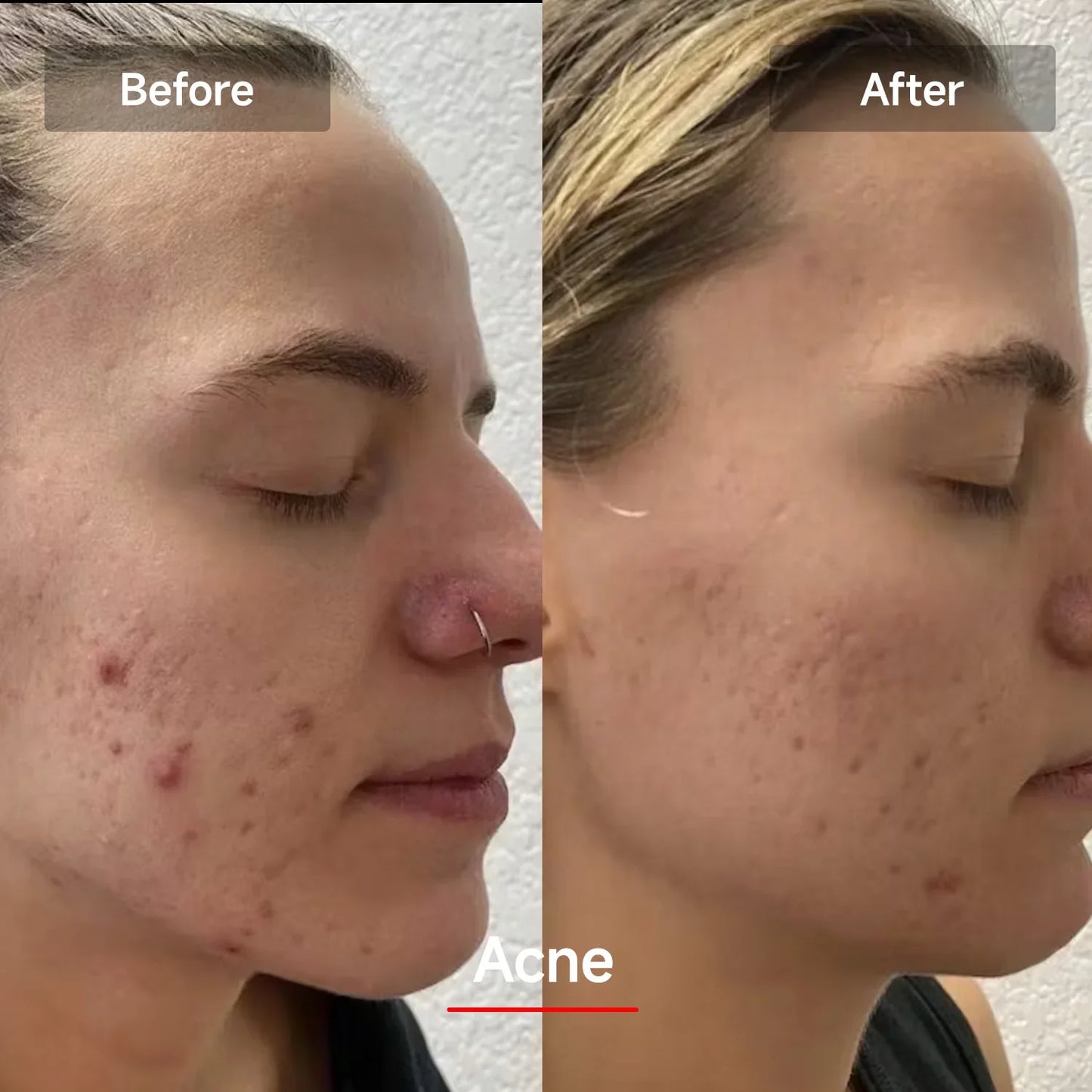 LED Face Mask with 7 Color Skin Revitalizer