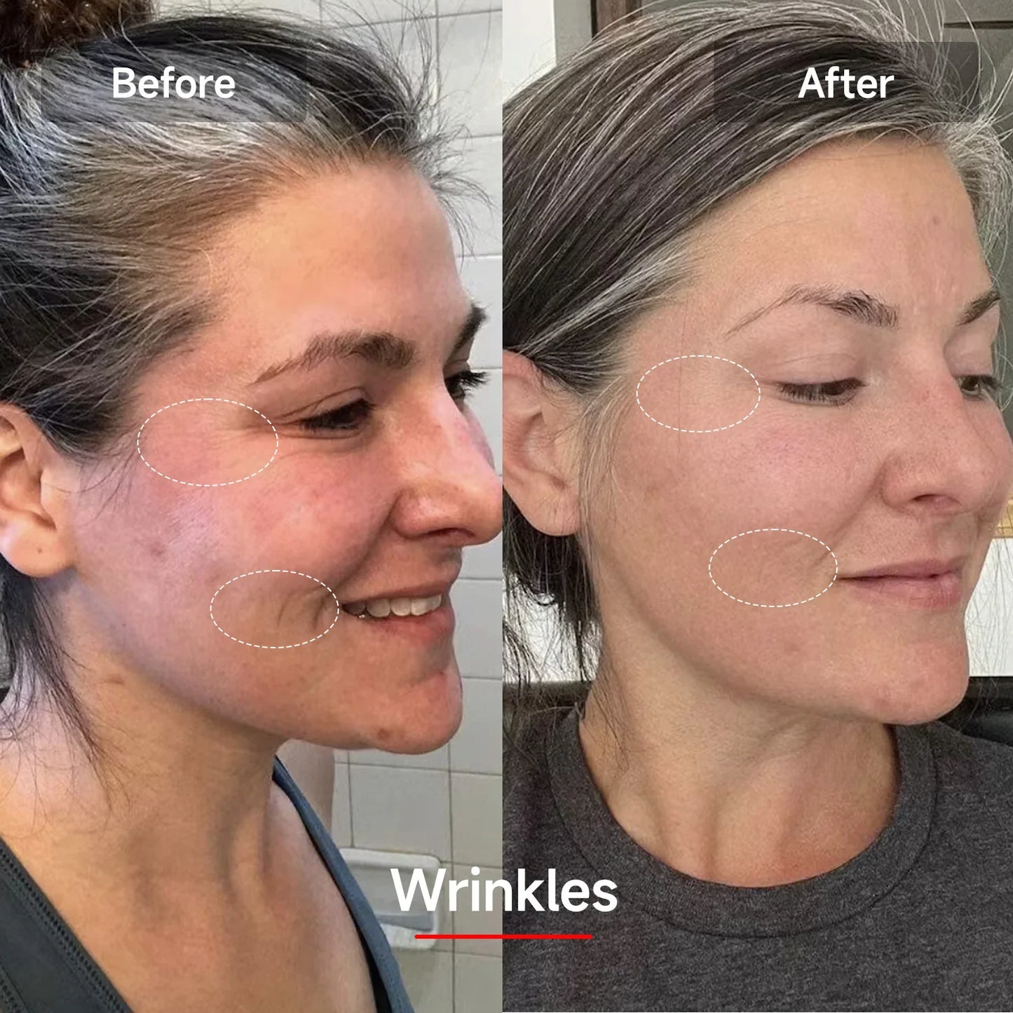 LED Face Mask with 7 Color Skin Revitalizer