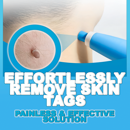 Easy At-Home Skin Tag and Mole Remover Pen