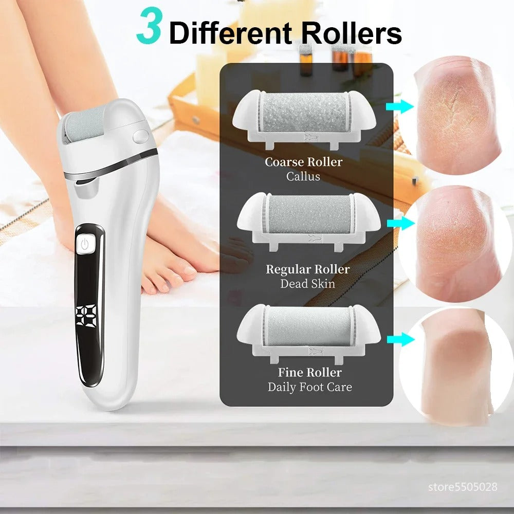 Fast Callus Removal Tool