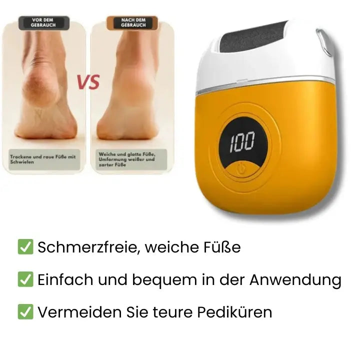Easy Foot Callus Remover - Halri