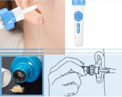 Effective Ear Cleaning Vacuum Tool Kit