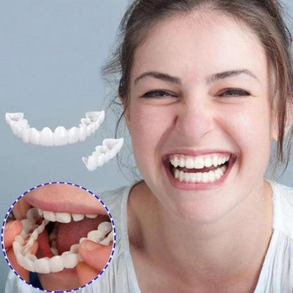 Complete Teeth Veneer Kit Upper Lower Set