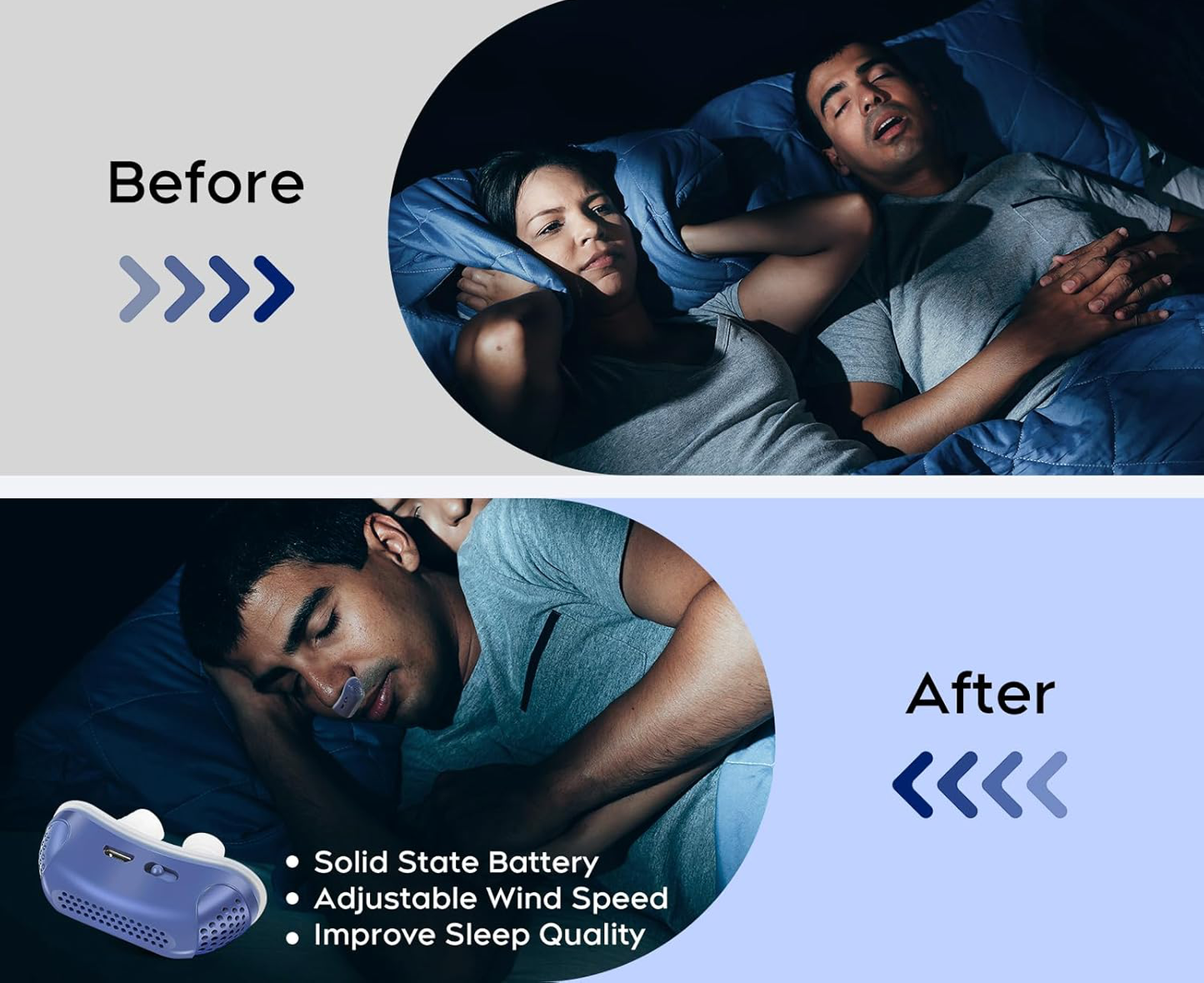 Compact Anti Snore Nasal Breathing Aid for Better Sleep