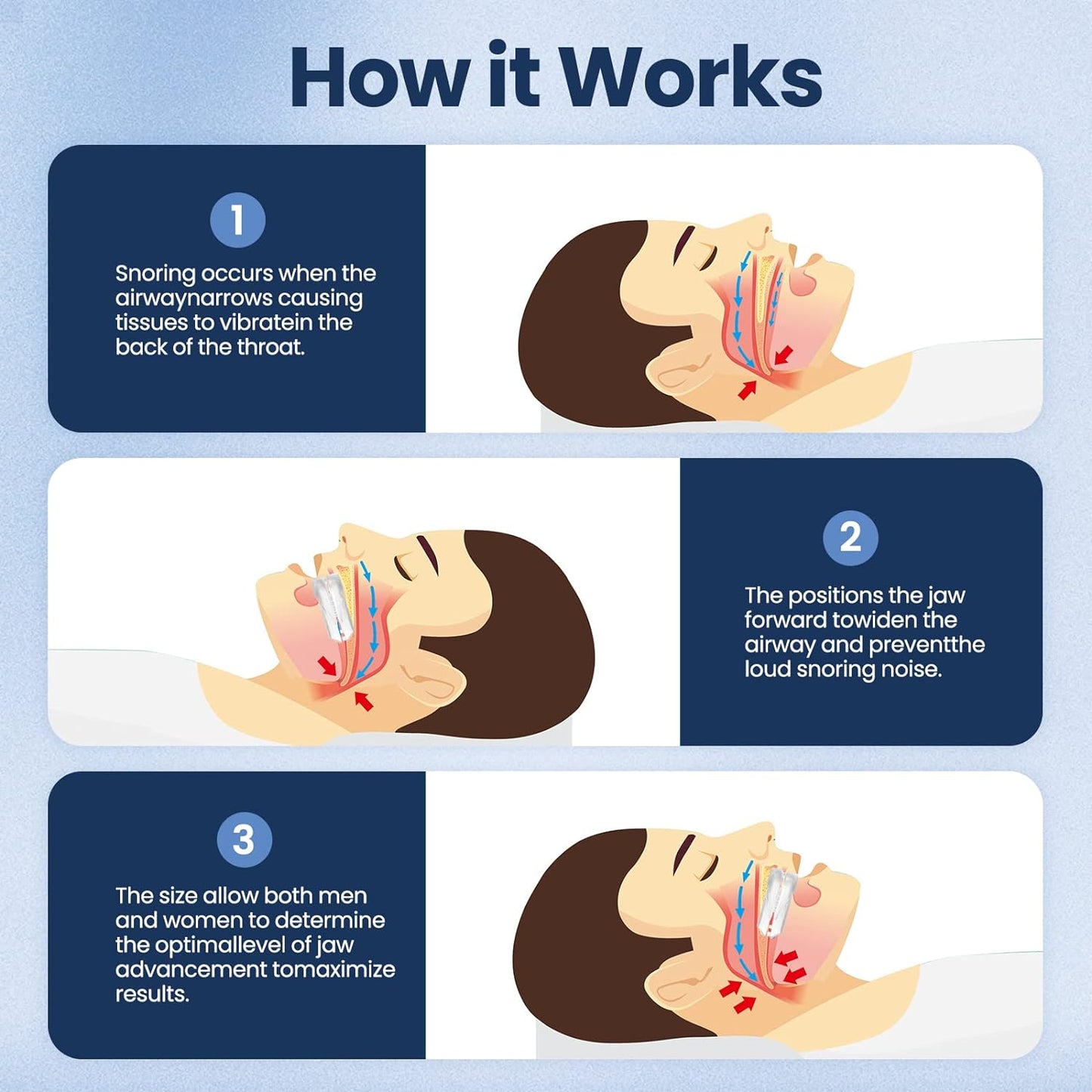 Sleep Apnea Snore Stopper Mouth Guard Device