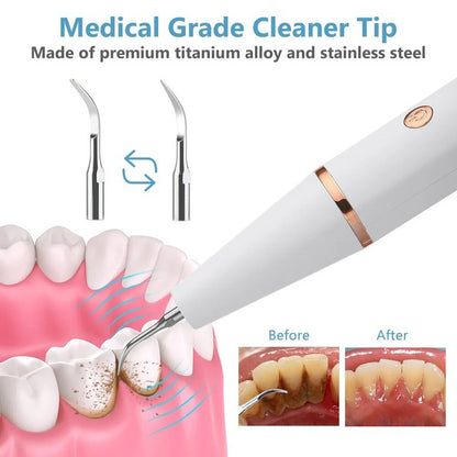 Easy Home Dental Scaling Tool with LED Light