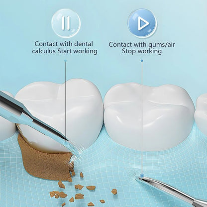 Easy Home Dental Scaling Tool with LED Light