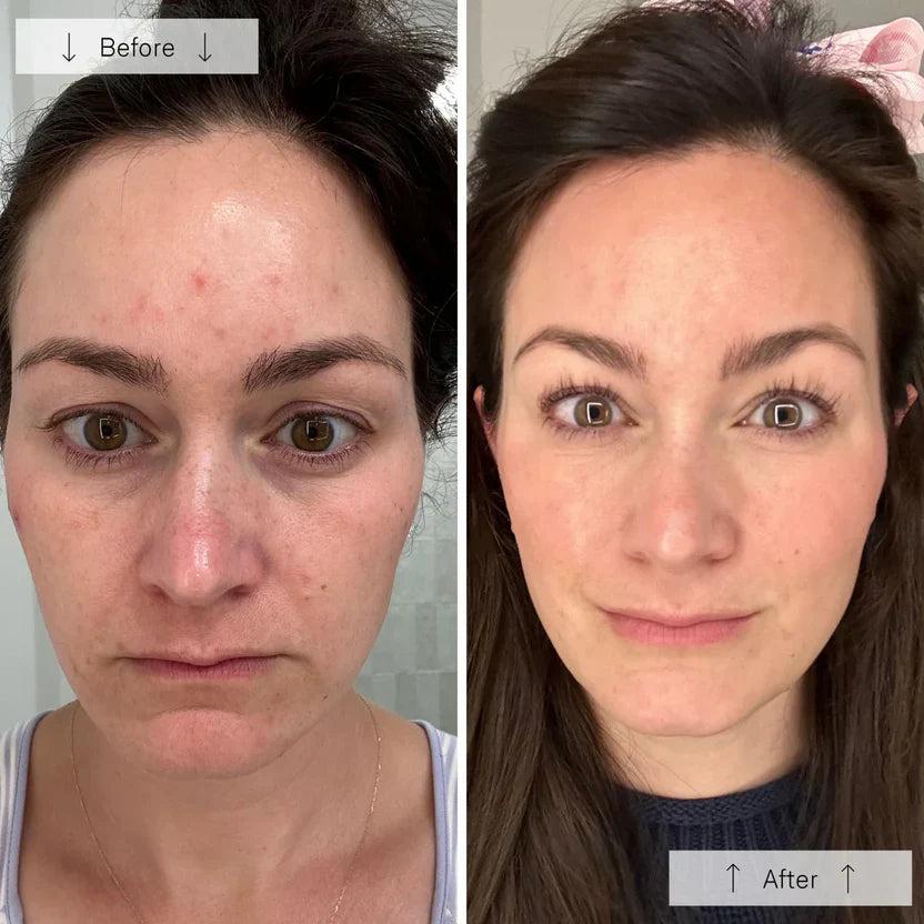 LED Face Mask with 7 Color Skin Revitalizer