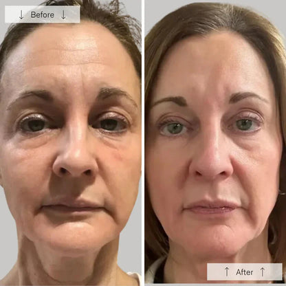 LED Face Mask with 7 Color Skin Revitalizer