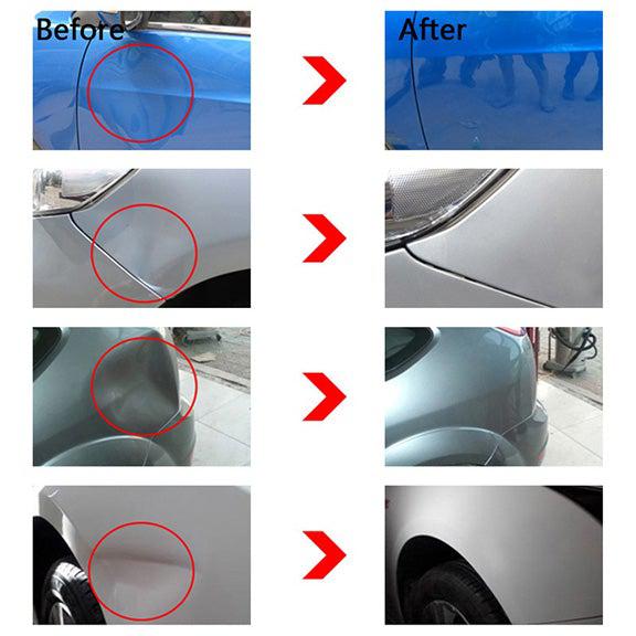 Easy Car Dent Fixer Removal Kit