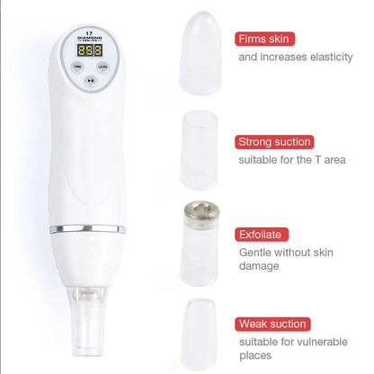 Electric Microdermabrasion Blackhead Remover Vacuum Pore Cleanser Tool