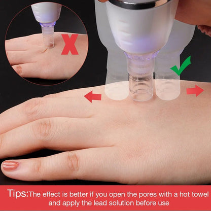 Electric Microdermabrasion Blackhead Remover Vacuum Pore Cleanser Tool