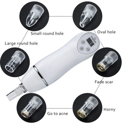 Electric Microdermabrasion Blackhead Remover Vacuum Pore Cleanser Tool