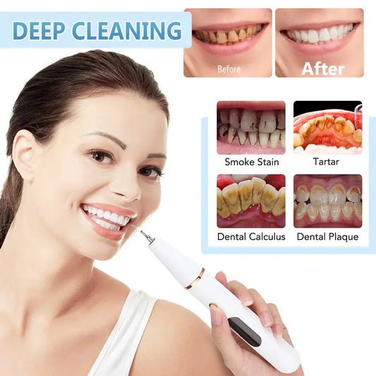 Professional Dental Plaque Remover with LED Light - Halri