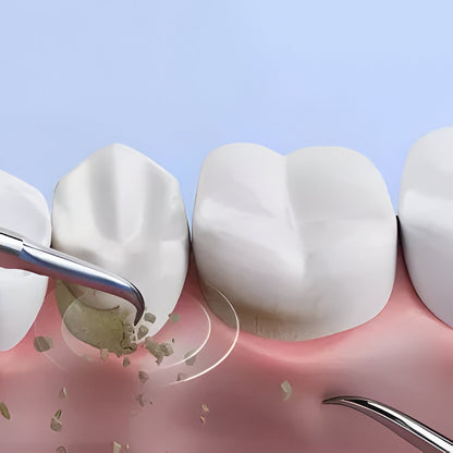 Professional Dental Cleaning Tool