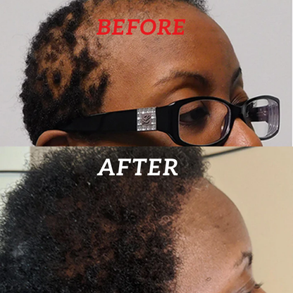 Natural Batana Oil for Skin and Hair Growth