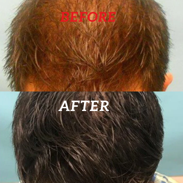 Natural Batana Oil for Skin and Hair Growth