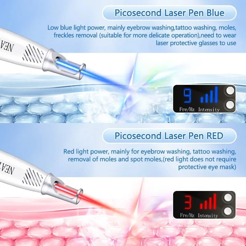 Picosecond Laser Pen for Mole, Dark Spot, Tattoo, Acne, and Skin Pigment Removal