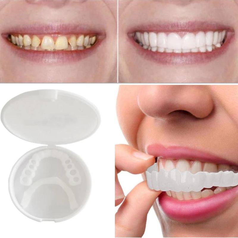 SecureFit - EasyWear Dental Prosthetic