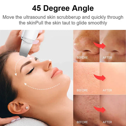 Deep Cleaning Facial Exfoliator