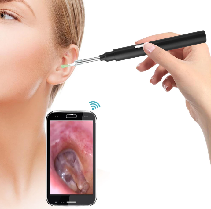 Wireless Ear Cleaner Camera 3MP Waterproof LED Light - Halri