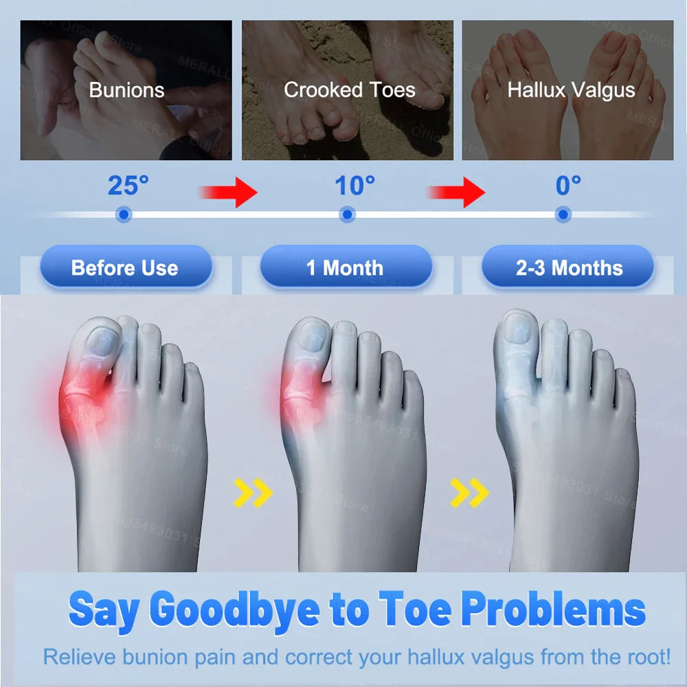 Comfortable Toe Spacer Support Brace | Soft Breathable Design