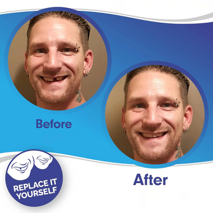 Custom Fit Dental Crown Tooth Cap