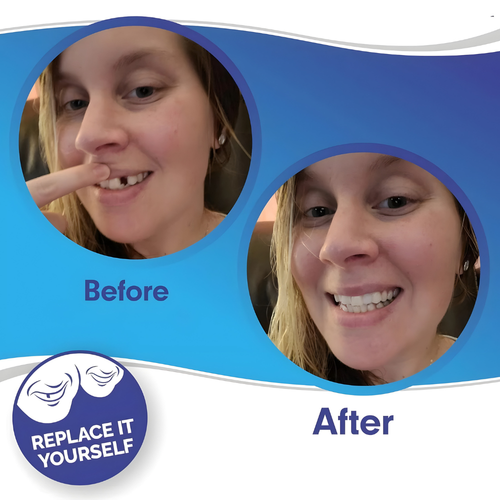 Custom Fit Dental Crown Tooth Cap
