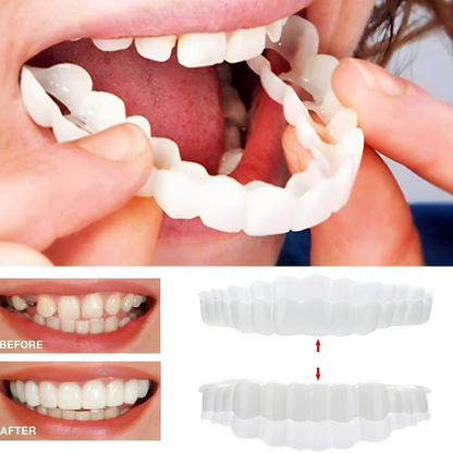 Custom Fit Dental Crown Tooth Cap