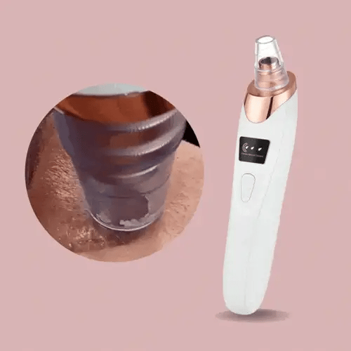 Easy Blackhead Remover Vacuum Tool - Halri