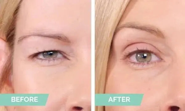 Easy to Use Natural Double Eyelid Tape