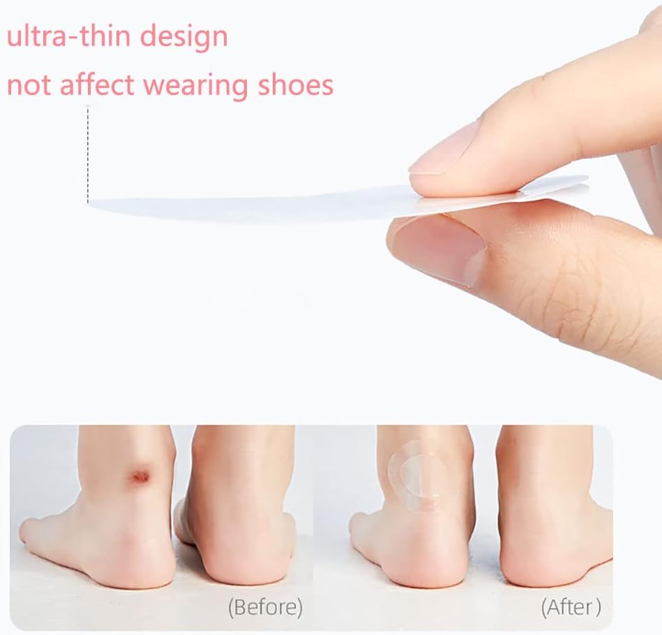 Clear Gel Blister Prevention Pads - Halri