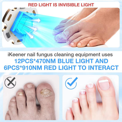 Effective Toenail Fungus Remover