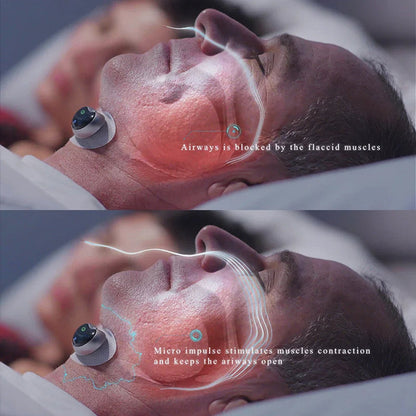 Effective Snore Stopper with Magnetic Therapy and Muscle Relief