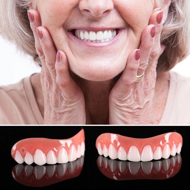 At Home Teeth Veneer Kit Easy Smile Solution - Halri