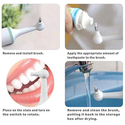 Gentle Dental Tartar Remover