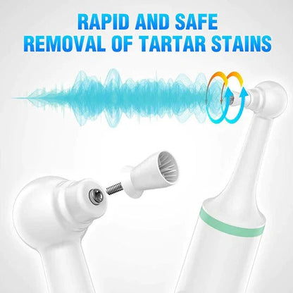 Gentle Dental Tartar Remover