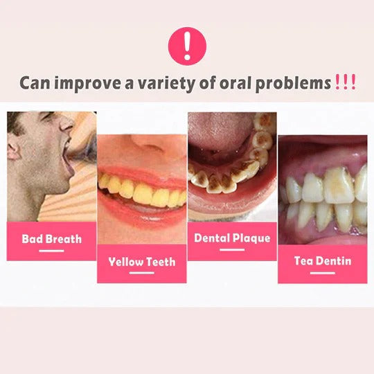 Gentle Dental Tartar Remover