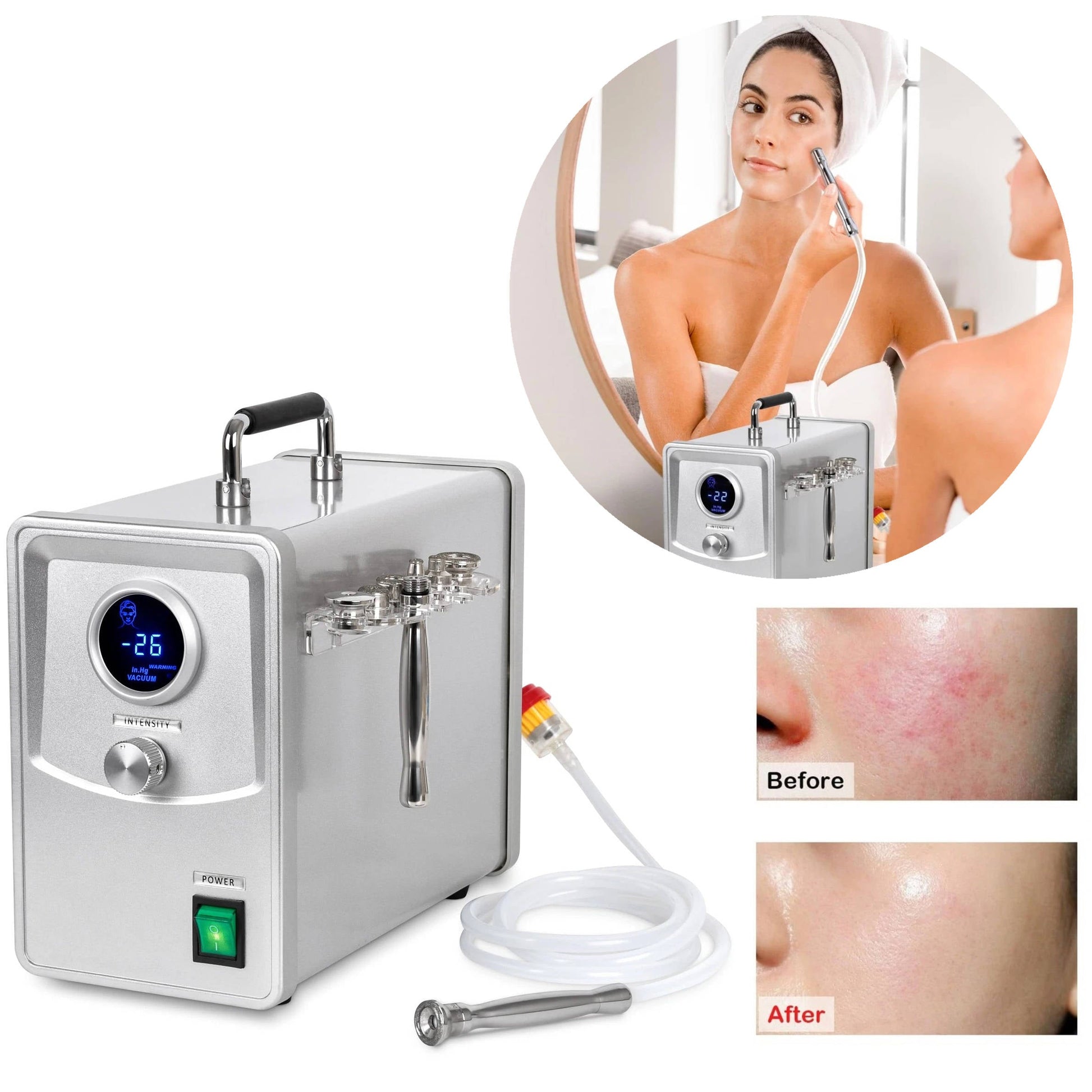 Advanced Diamond Skin Exfoliation Facial Device - Halri