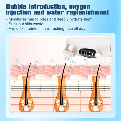 Portable Blackhead Remover Vacuum Cleaner