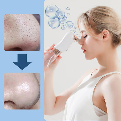 Portable Blackhead Remover Vacuum Cleaner
