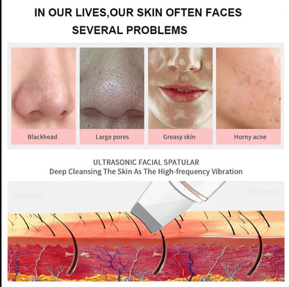 Deep Cleaning Facial Exfoliator