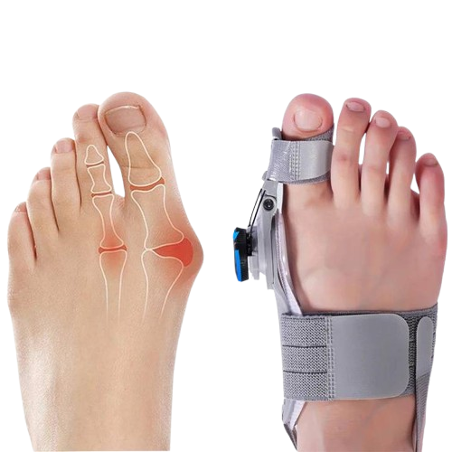 Comfortable Bunion Relief Toe Separators - Befez