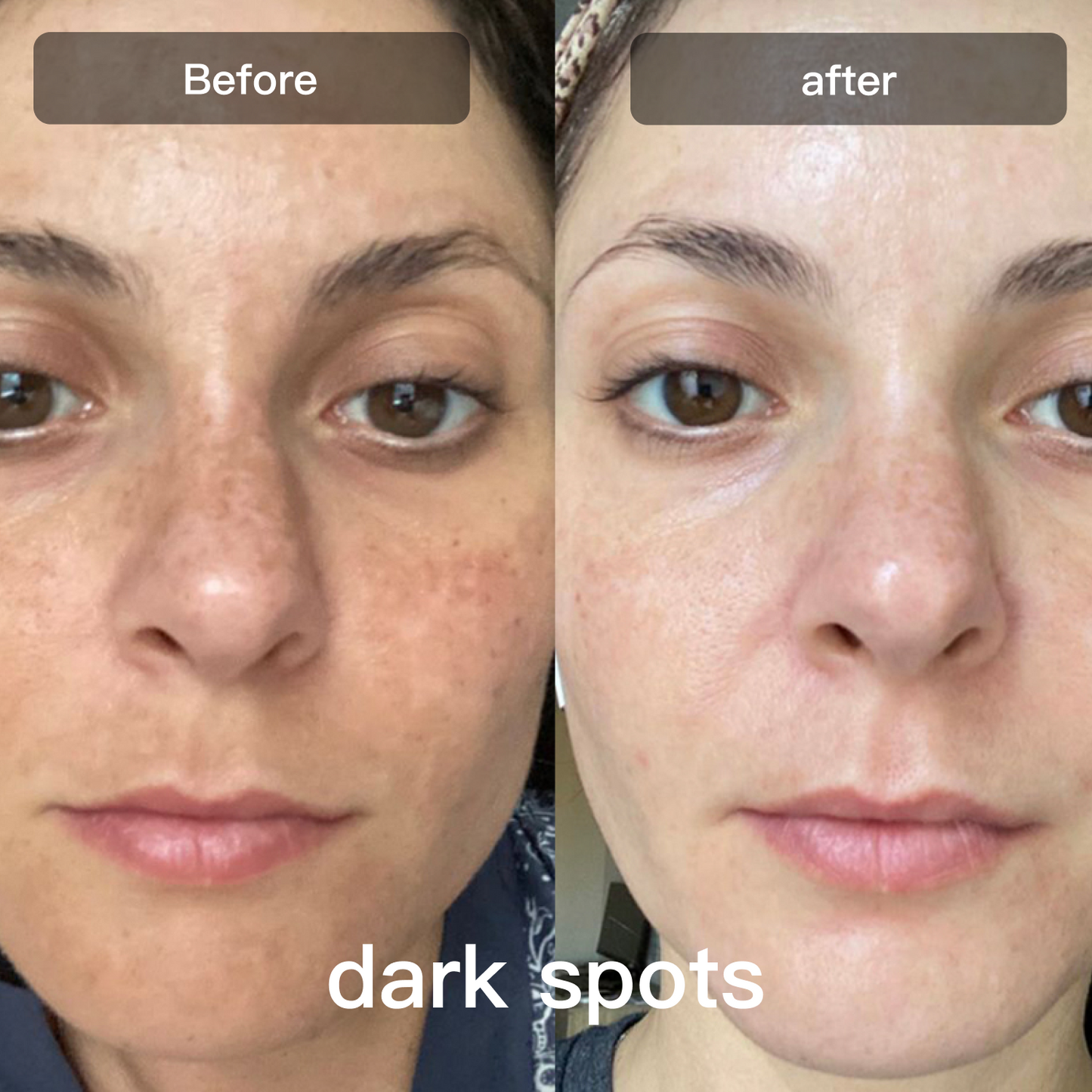 Advanced 7 Color LED Skin Care Device